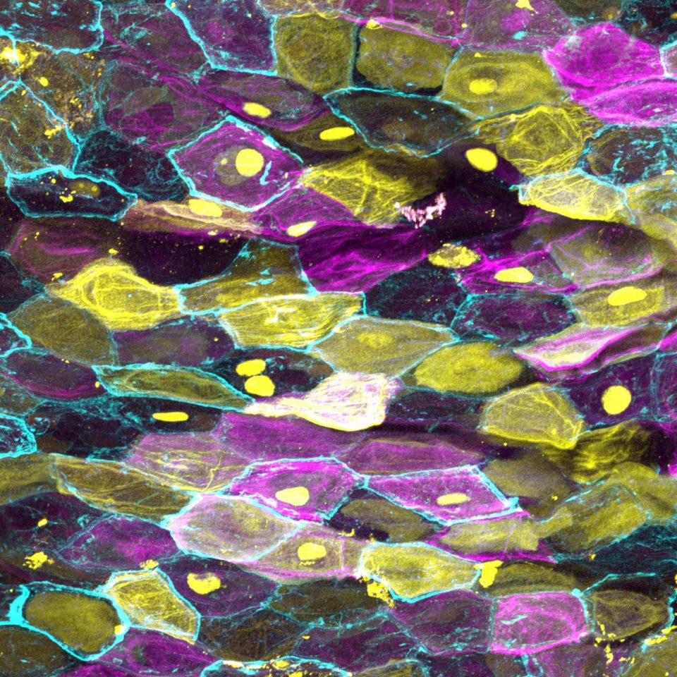 skin keratinocyte confetti caleb dawson science art