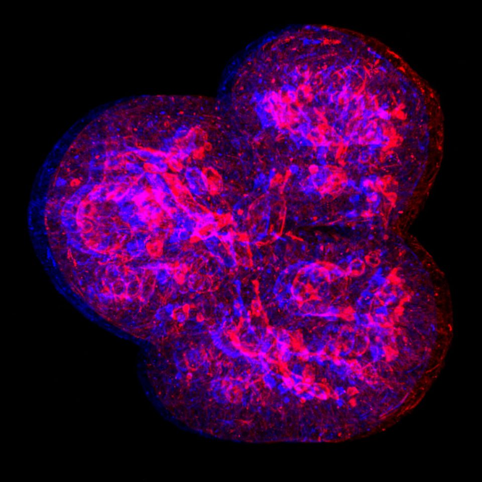 Breast tissue organoid in 3D