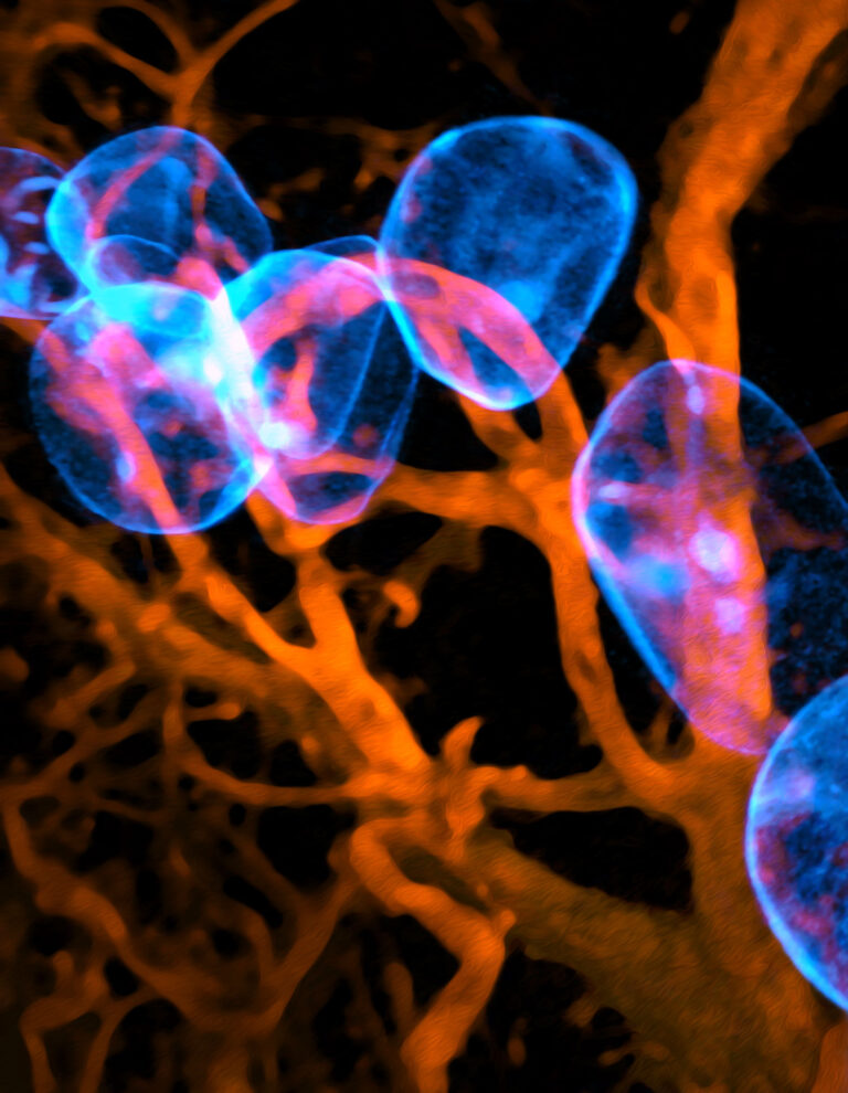 Breast fat cells – The breast alveoli and ducts that make and transport milk are embedded in fat tissue. Fat tissue is made up of the large blue adipose cells seen here, which are enwrapped by blood vessels.