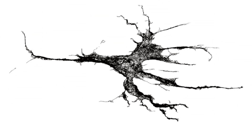 A microscopy image of a fibroblast that appears black, spindly and ominous on a white background. This is one of the many fibroblasts that stretch throughout breast tissue. They make connective tissue that binds cells together and gives our organs their stiffness.